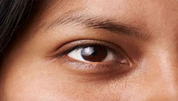 Dark Circles દુર થશે 15 દિવસમાં જ, અઠવાડિયામાં 2 વખત આંખ નીચે લગાડો આ વસ્તુ